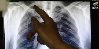 Pakistan may face a lack of x-ray films, warns importer
